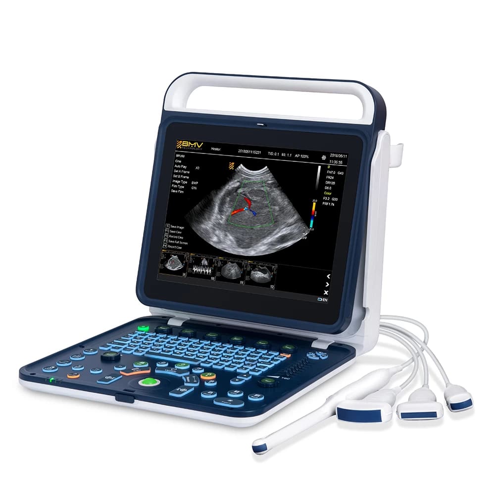 Global Portable Color Ultrasound Equipment Market to Reach USD 926 Million by 2025